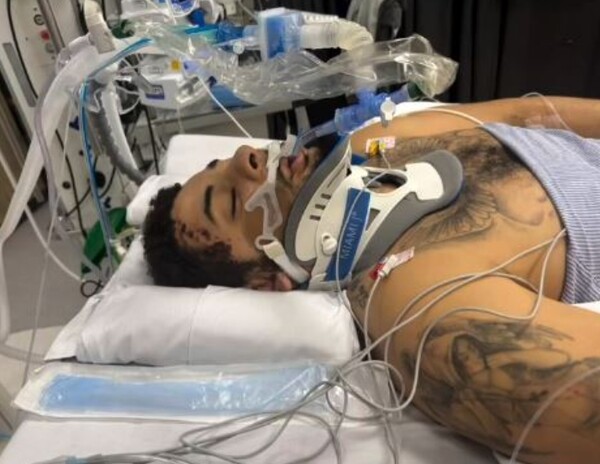 '꽃다운 31세인데' 참극! 안타까운 비보...음주운전 차량에 치여 다리 절단