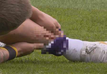 충격! "심약자는 도저히 눈뜨고 보기 힘들 정도"...'끔찍 부상' 당한 前 토트넘 출신 홀트비, 다행히도 의연한 모습 "곧 돌아오겠다"