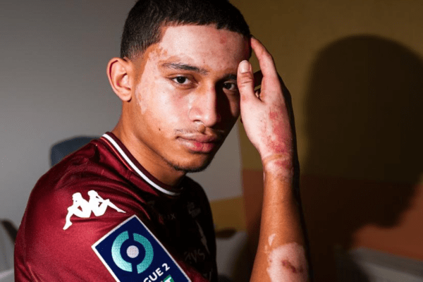 '이젠 행복하길'…'대형 화재 참사' 여친 구하고, 전신 화상 입은 19세 유망주, 감격의 복귀전 이어 프로 계약 체결까지 '진정한 인간 승리'